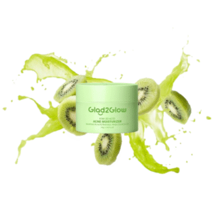 Glad 2 Glow Kiwi 3D Acid Moisturizer